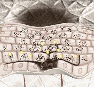 中国人去泰国打美白针,泰国美白针真实事件