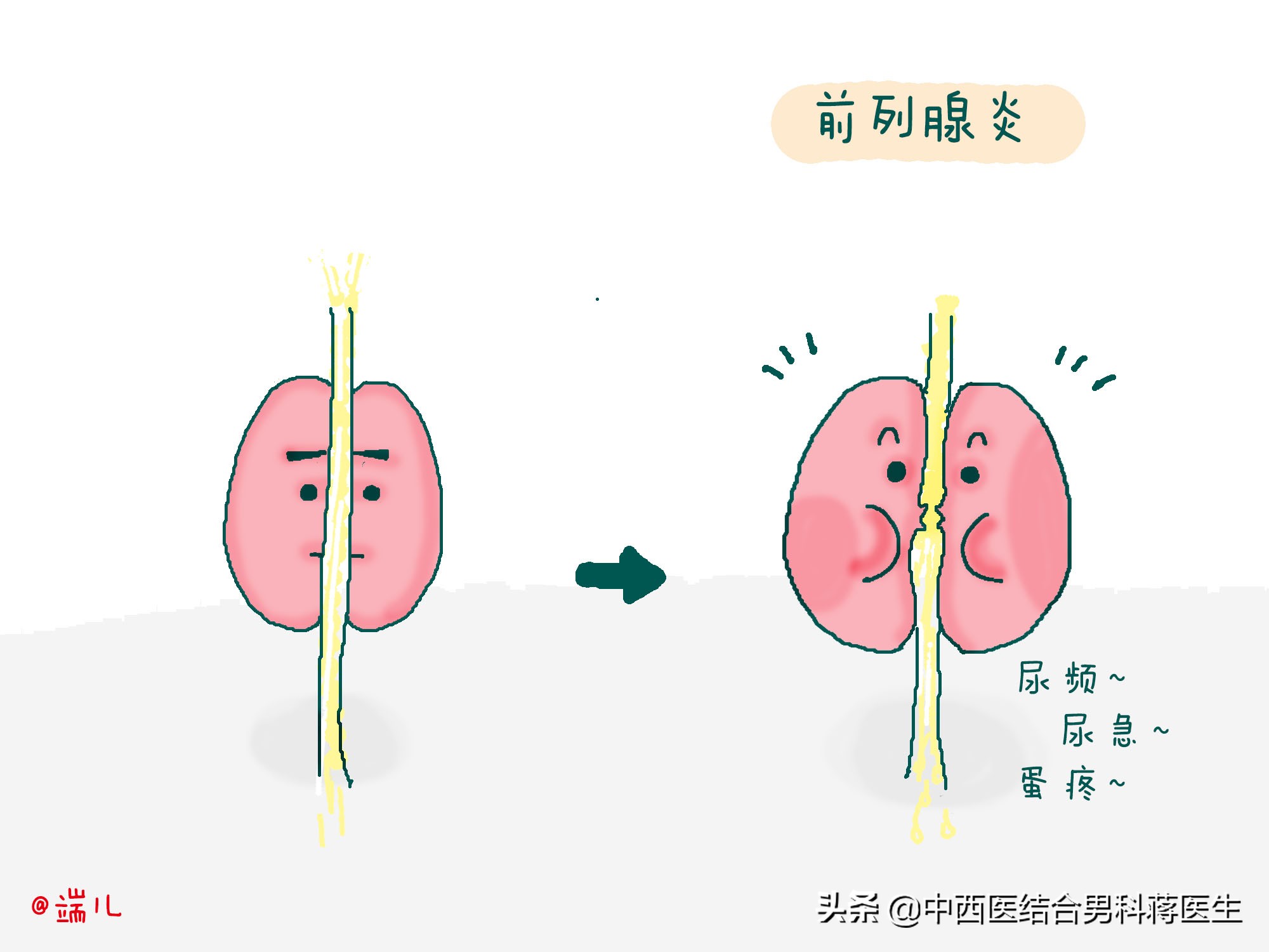 常见男科疾病误区,男科病症科普