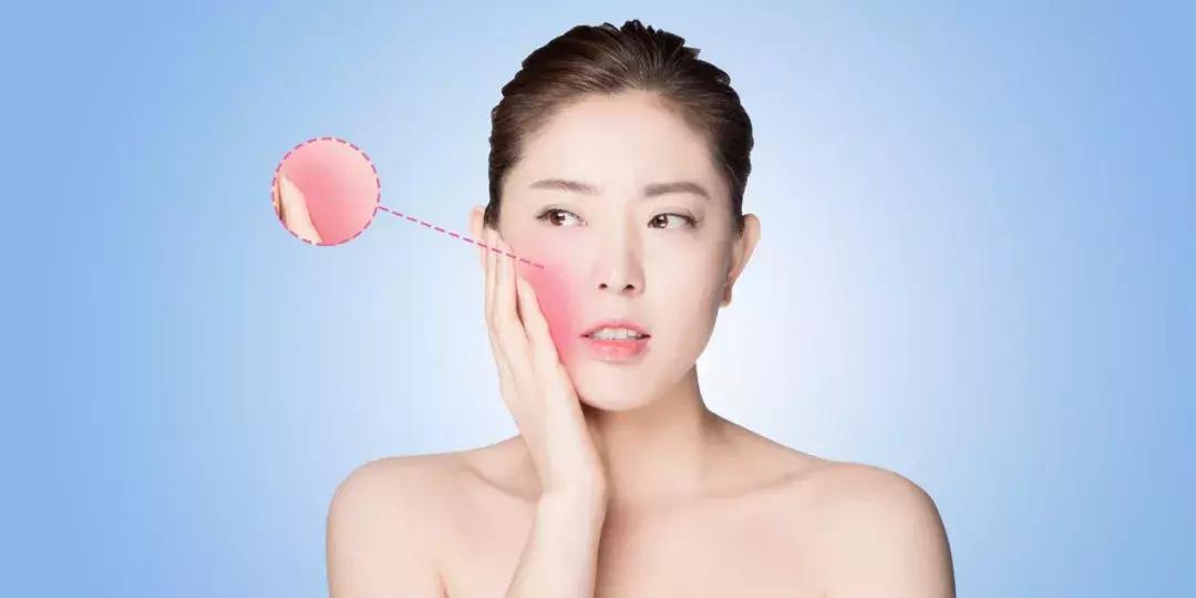 激素脸的特征和症状,激素脸形成的特征