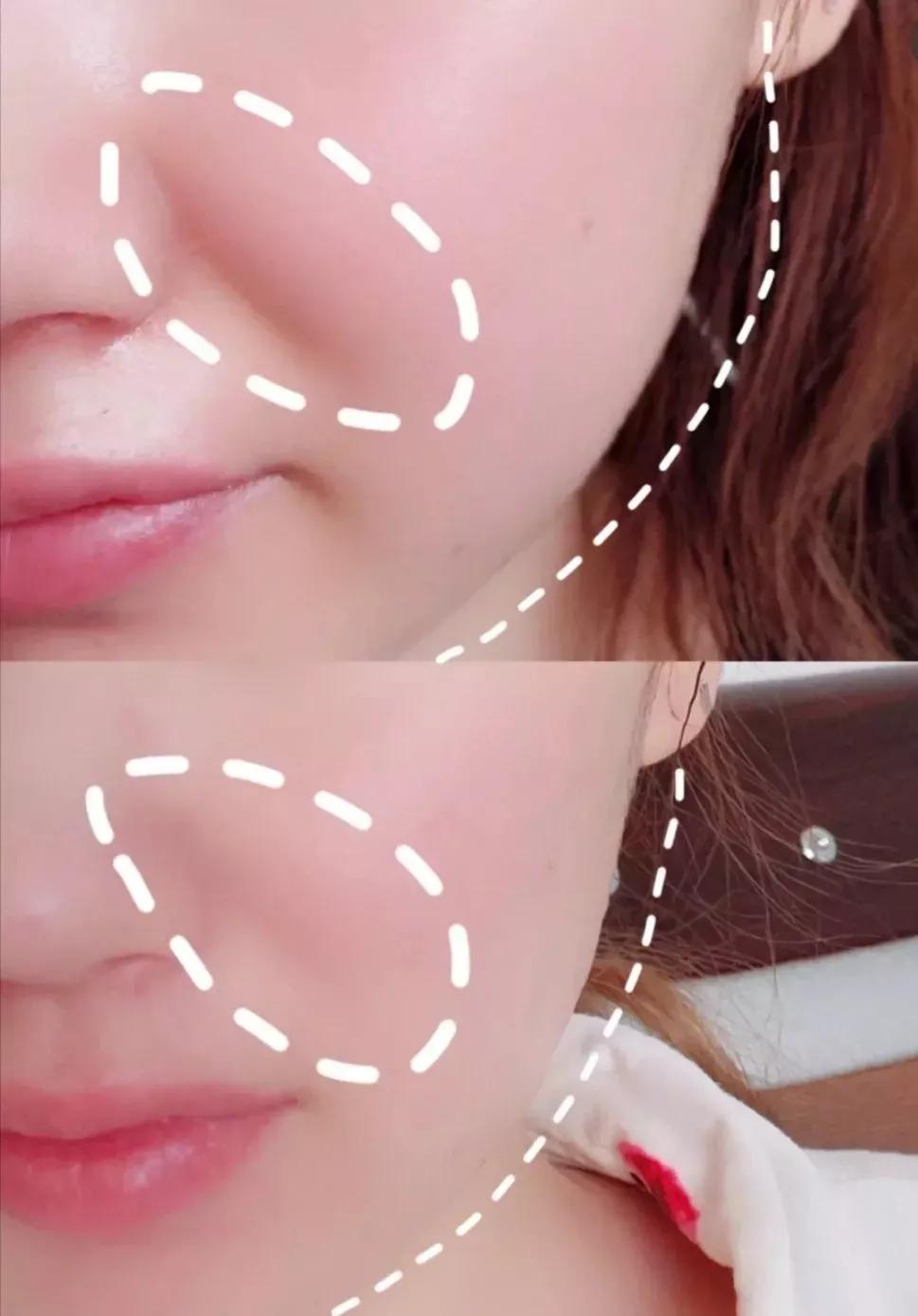 刘亦菲保养皮肤的方法,30岁皱纹多怎么修复