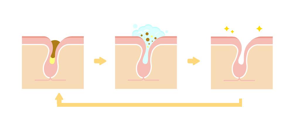 碘伏十滴水去黑头,十滴水碘伏祛黑头正确使用步骤