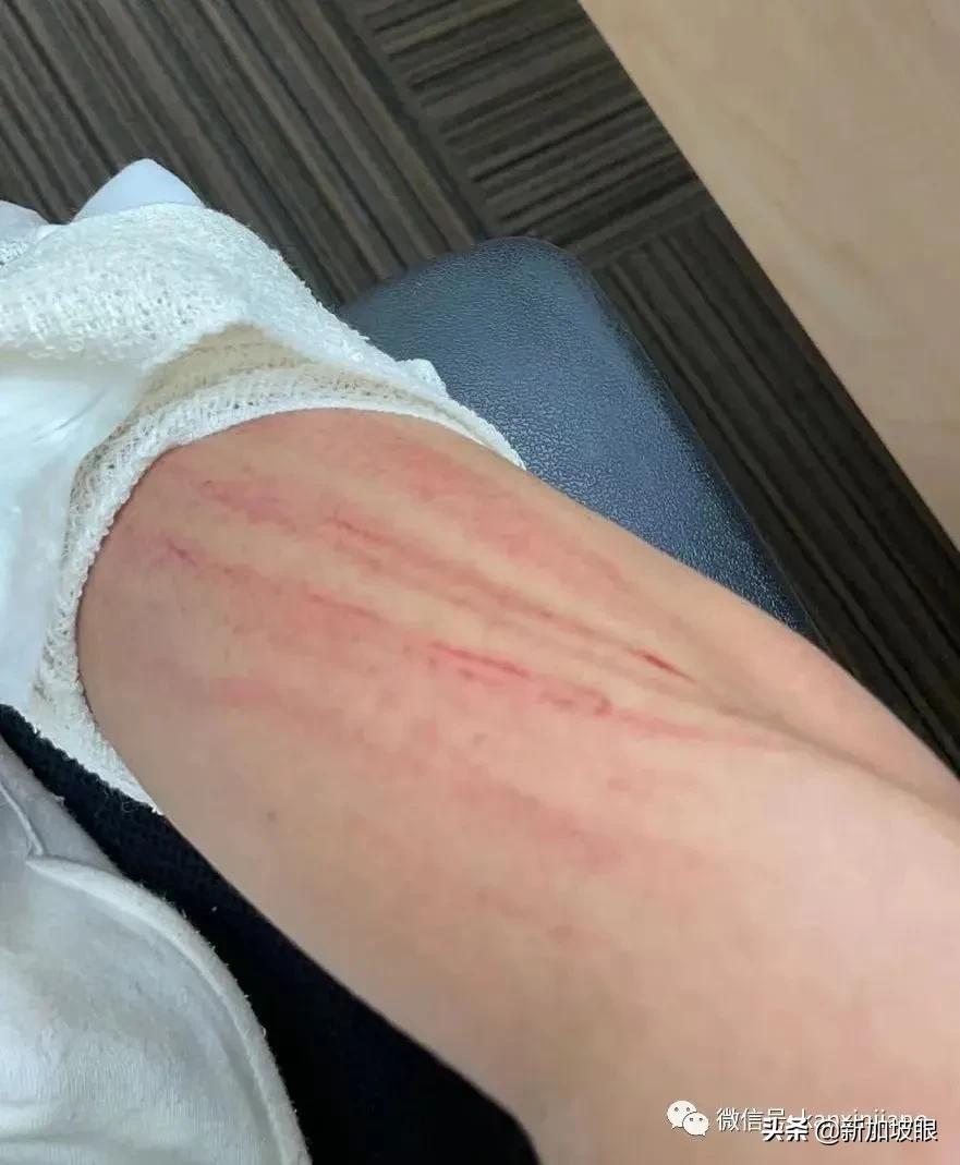 中国留学生在新加坡街上无辜被打，还遭骂“中国病毒”