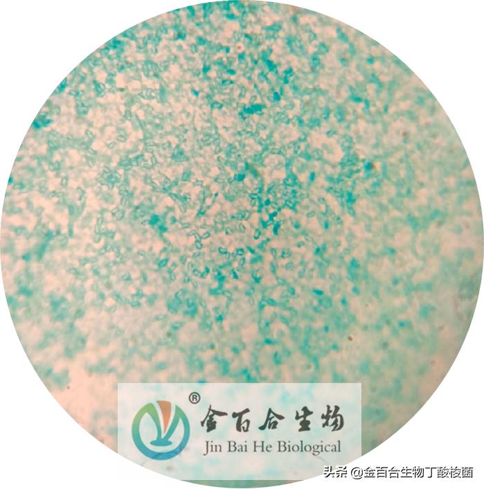 革兰氏染色显微镜下的图手绘,革兰染色用的显微镜是什么