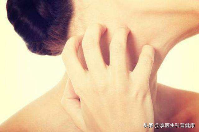 热的荨麻疹怎么治疗才能彻底根除,荨麻疹为什么到热天就发呢