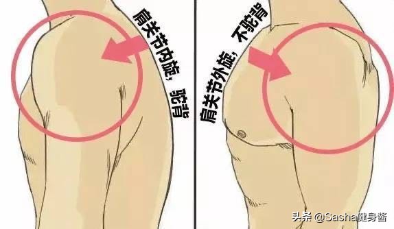 一招改善圆肩驼背头前倾,圆肩驼背矫正最有效方法坐着