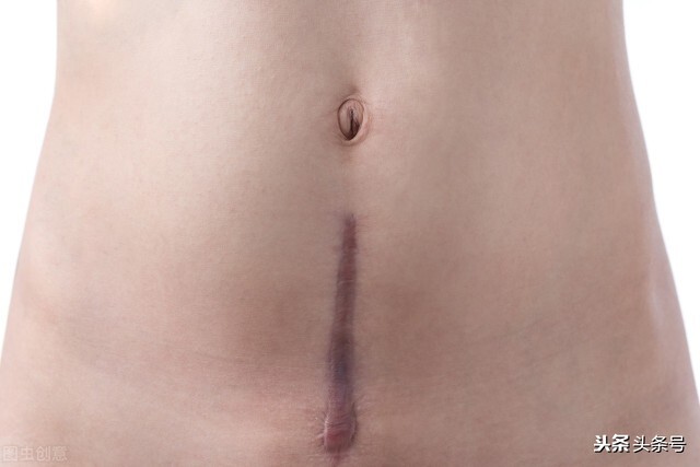 难产大出血孩子没保住,生宝宝大出血难产死活不出来