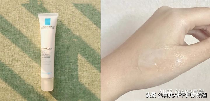 维a酸药膏治疗痘痘效果,中成药维a酸类口服药有哪些