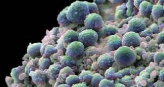 不少梅毒病人竟是六七十岁的老人！是老人变坏了吗？