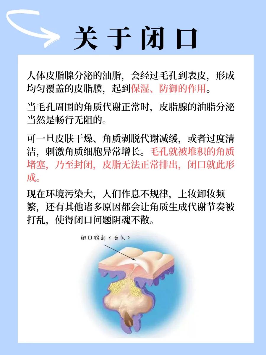 什么是闭口怎么处理,你知道什么叫闭嘴吗