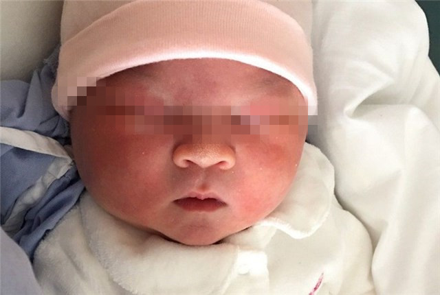 宝宝出生后体重怎么算,宝宝出生之后重量下降怎么回事