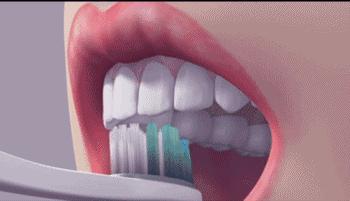 牙齿上火牙龈痛怎么止痛,牙龈肿是牙齿坏了还是上火引起的