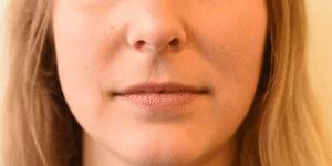 facs的全称是什么,facs面部编码系统