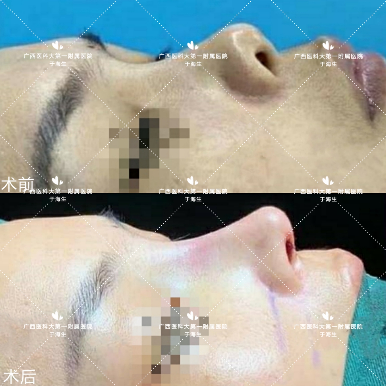 有哪些明星是朝天鼻,塌鼻好看的明星