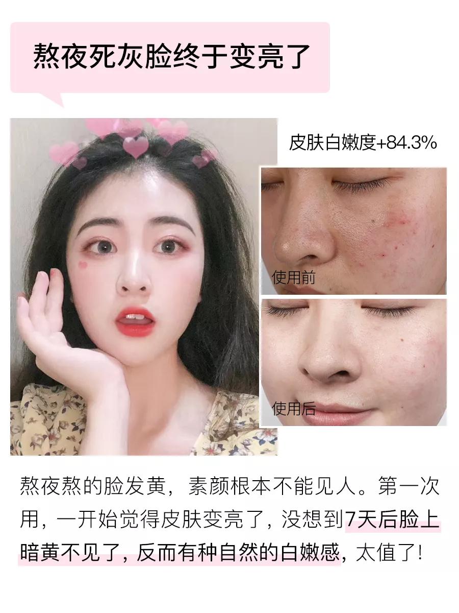 急救面膜3分钟见效,急救补水面膜爆款面膜