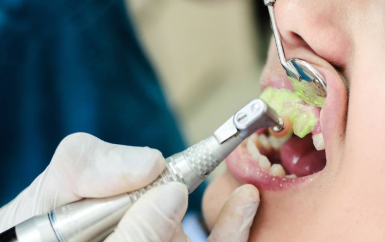 如何使黄牙齿变白的简单方法,牙齿黄怎么办变白小妙招视频