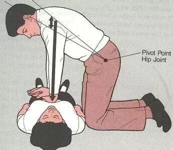 有人倒地了该不该救,有人倒地不是所有都要心肺复苏