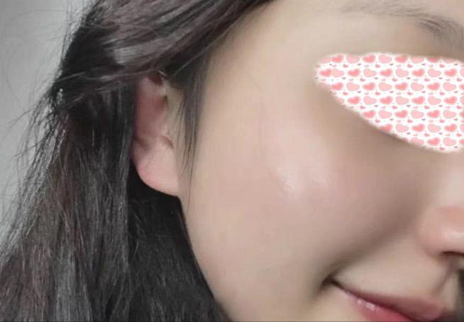 角质层薄怎么办吃什么药,角质层薄怎么办用什么护肤品