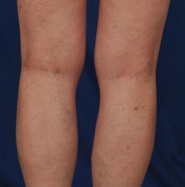 如何快速放松肌肉腿,怎么用筋膜枪放松腿部肌肉