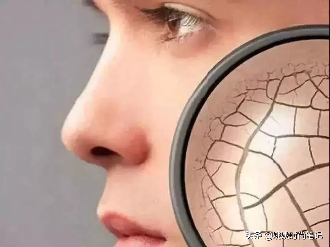 春季皮肤过敏干燥起皮怎么办,过敏是皮肤干燥引起的吗