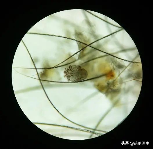 猫咪过敏是属于炎症反应吗,猫咪过敏怎么排除过敏源