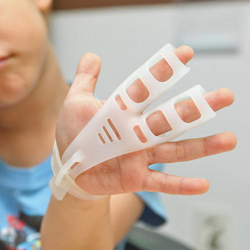 孩子咬指甲怎么办快速解决方法,孩子咬指甲怎么心理疏导