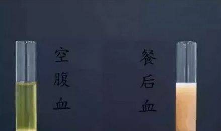 空腹抽血前喝了一口水影响效果吗,抽血为什么要空腹还不能喝水