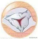 心脏说明书,这份通俗易懂的心脏说明书请收好