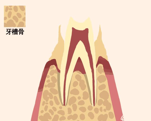 牙齿摔松动怎么办,牙齿松动恢复秘方