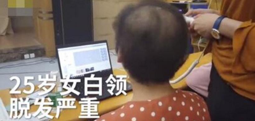25岁白领惨变大妈秃如其来的不止HR…