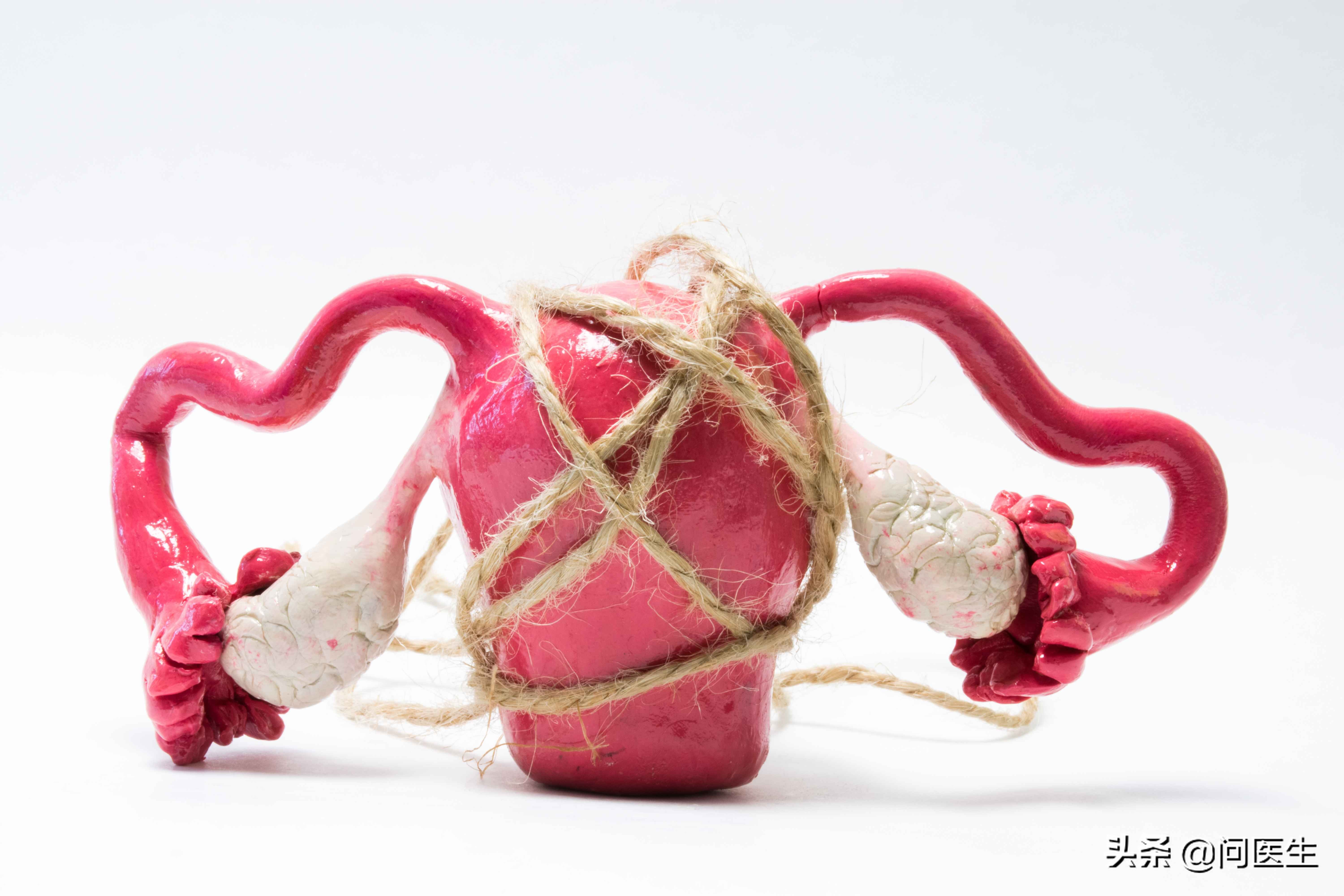 宫颈息肉对怀孕有什么影响,有宫颈息肉会影响无创检查吗