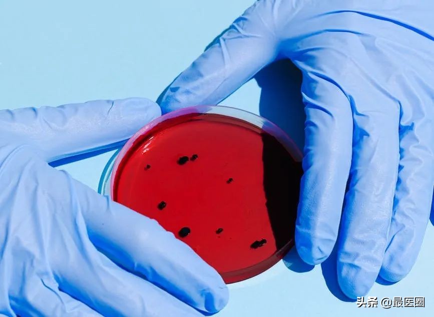 看似平平无奇的尿液,在向我们身体发出了什么警报?