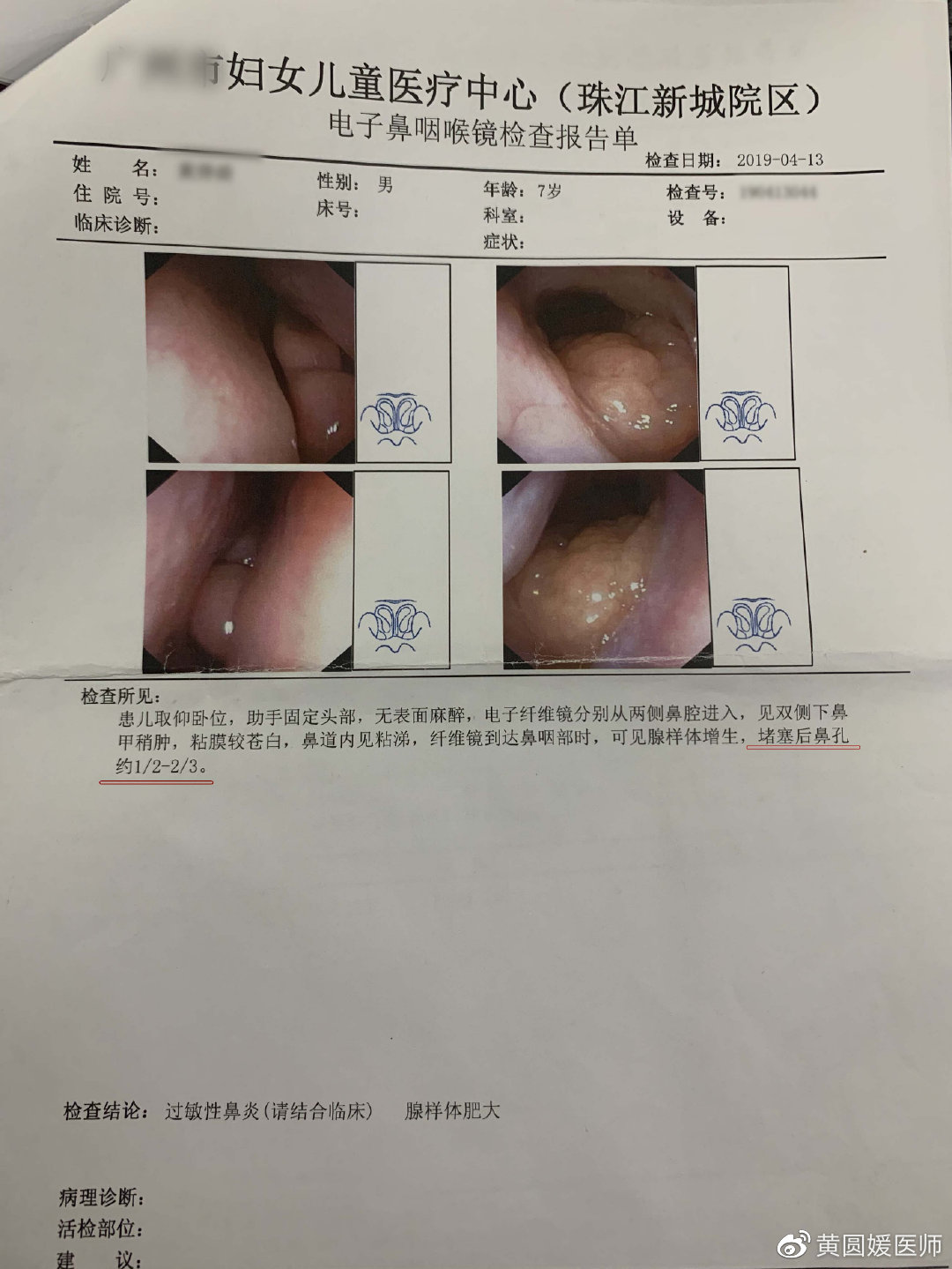 感冒连续打五六个喷嚏,感冒喘气像打呼噜似的是怎么回事