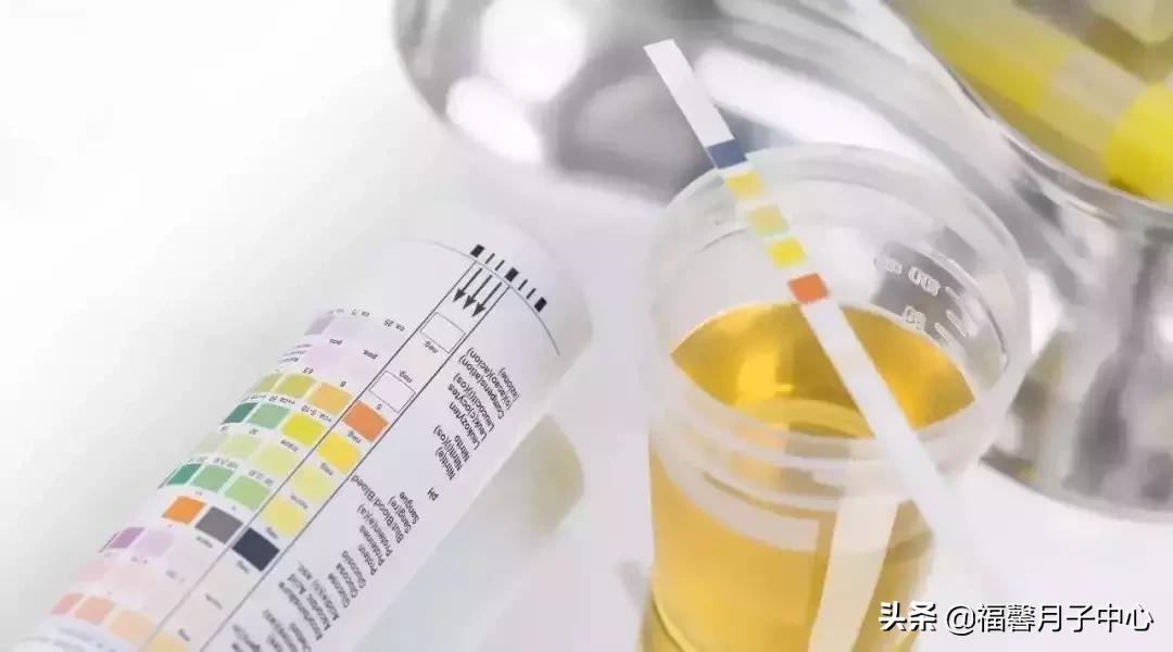 每次产检都要验血验尿吗,产检每次都验尿是查什么