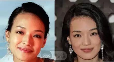 颅顶太低如何自救,颅顶低怎么自救