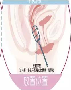 女*福性**利！苏州科技城医院产后盆底康复综合门诊开展，免诊察费哟