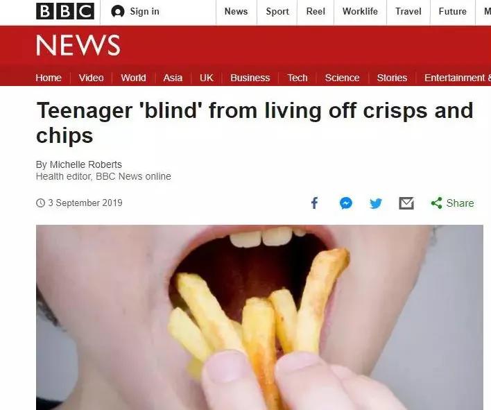 眼科医生谈电子产品对眼睛的伤害,眼科医生对近视的影响