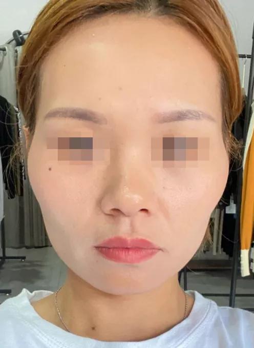 不对称脸图片改善动作,不好看的脸型怎么改善