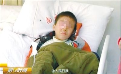 男童全身8层皮肤烧伤,6岁男童大面积烧伤