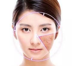 酒糟鼻如何应对,酒糟鼻是常见的美容病该如何应对