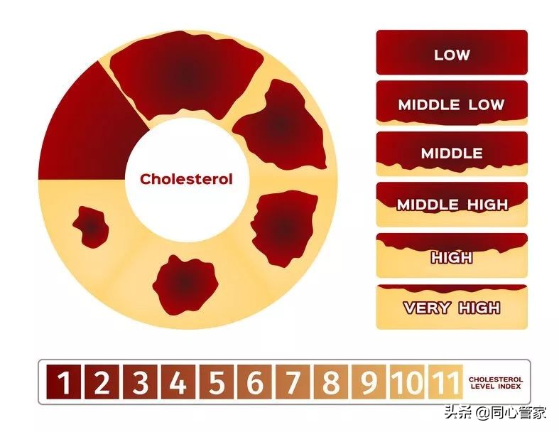 血管狭窄如何扼住生命的咽喉？让你全身器官都遭殃？