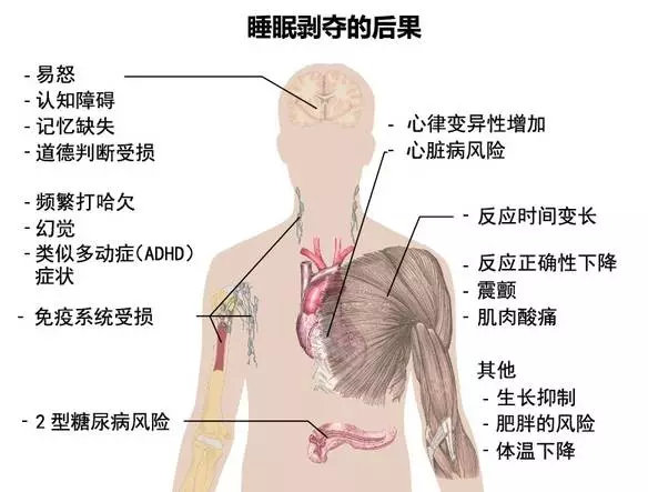 21岁住进icu,在icu住了34天