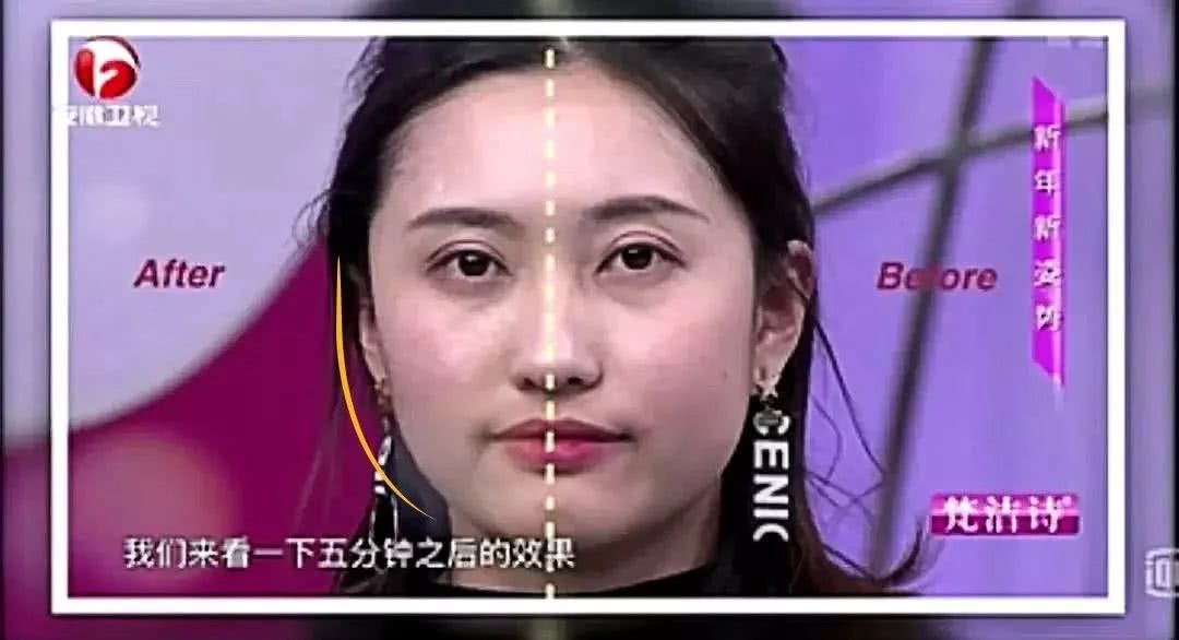 号称“1小时逆龄10年”的微整？我亲身体验了