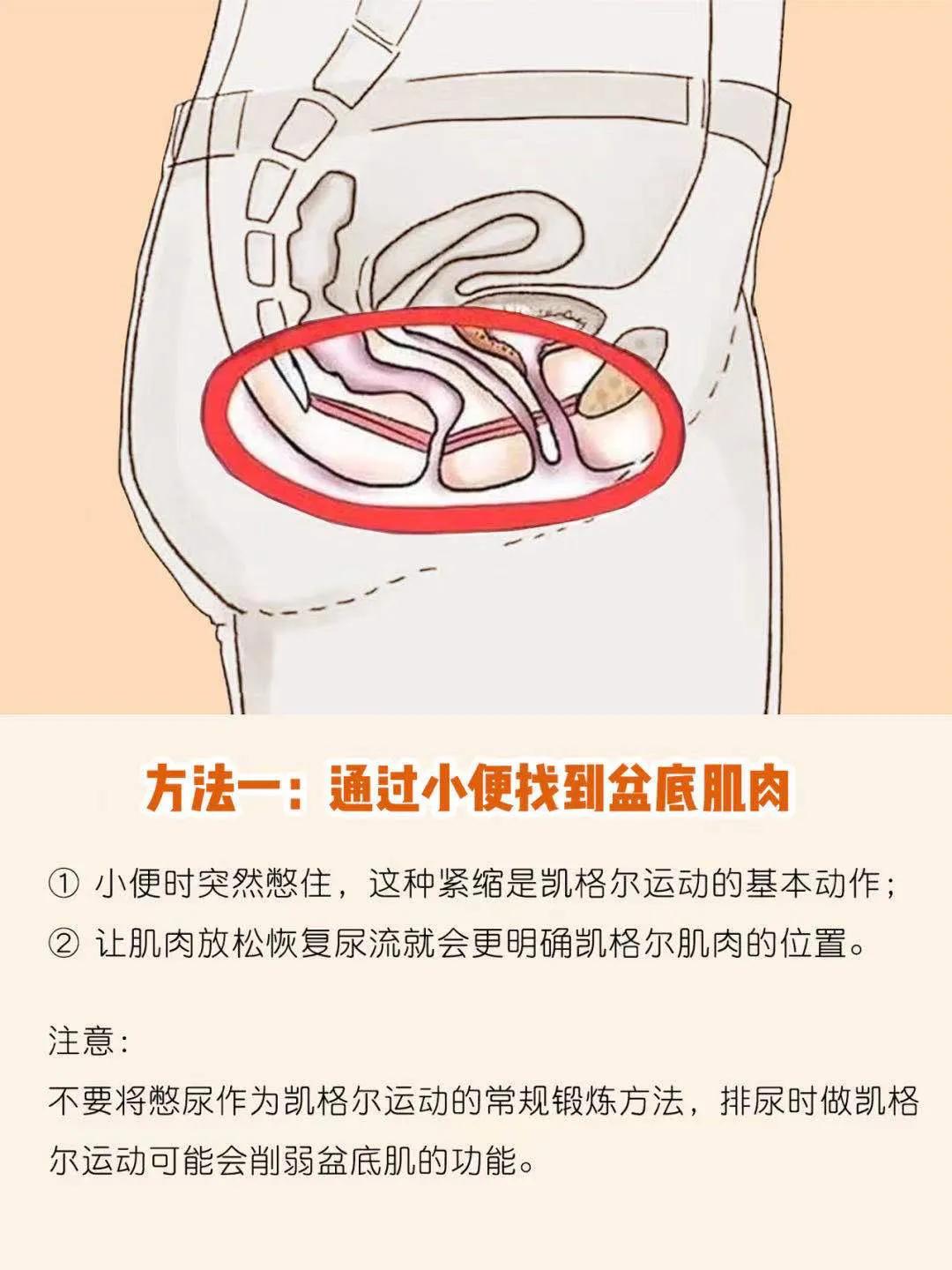 盆底肌修复凯格尔运动,孕妈妈产后康复训练