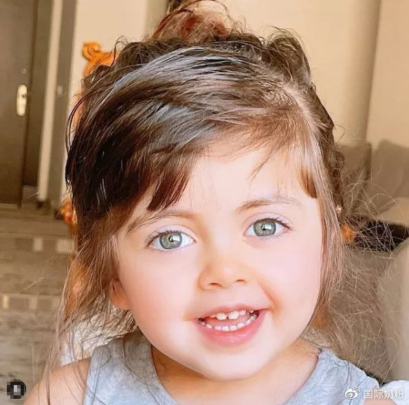 宝宝眼睛红肿流泪是上火啦?错!这些才是主要原因