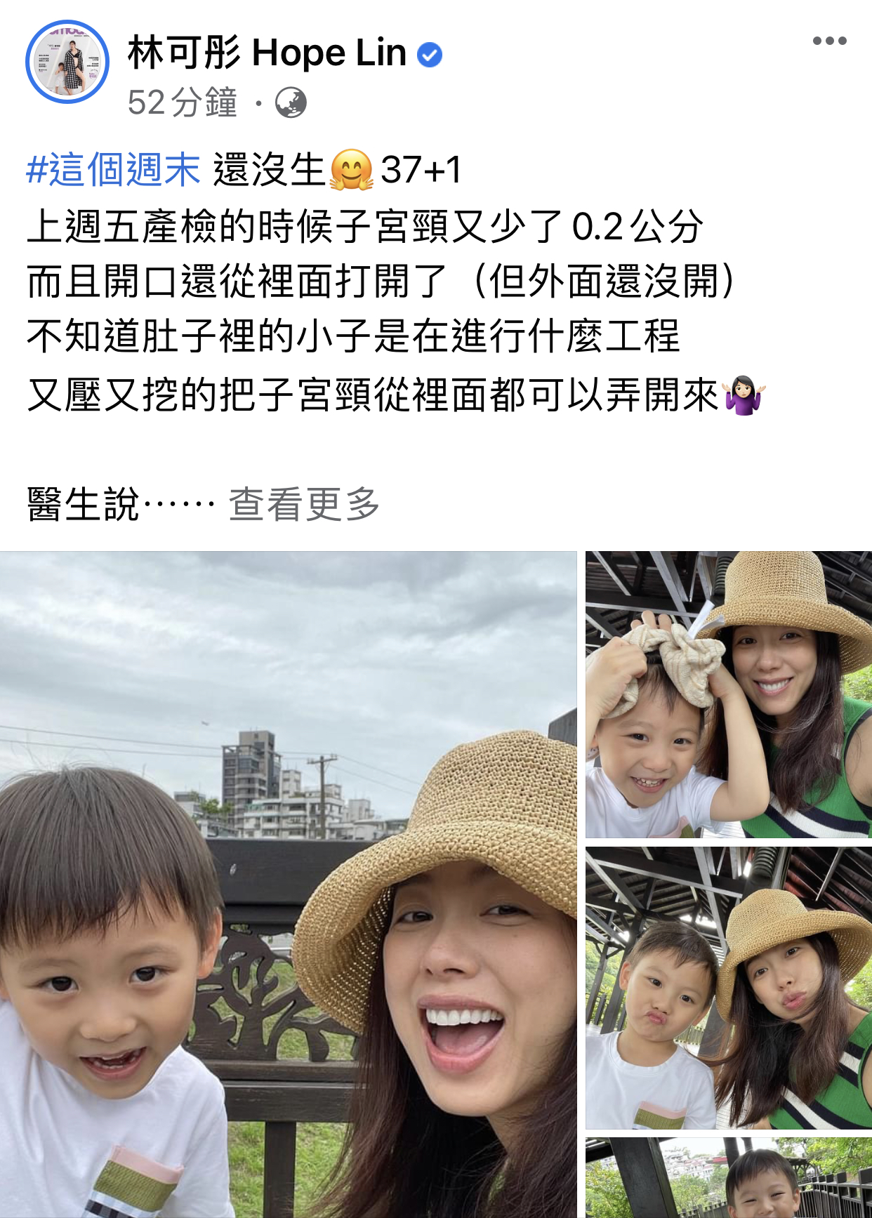 担心早产!40岁台湾女星嫁银行总裁怀2胎,检查子宫颈只剩1.3公分