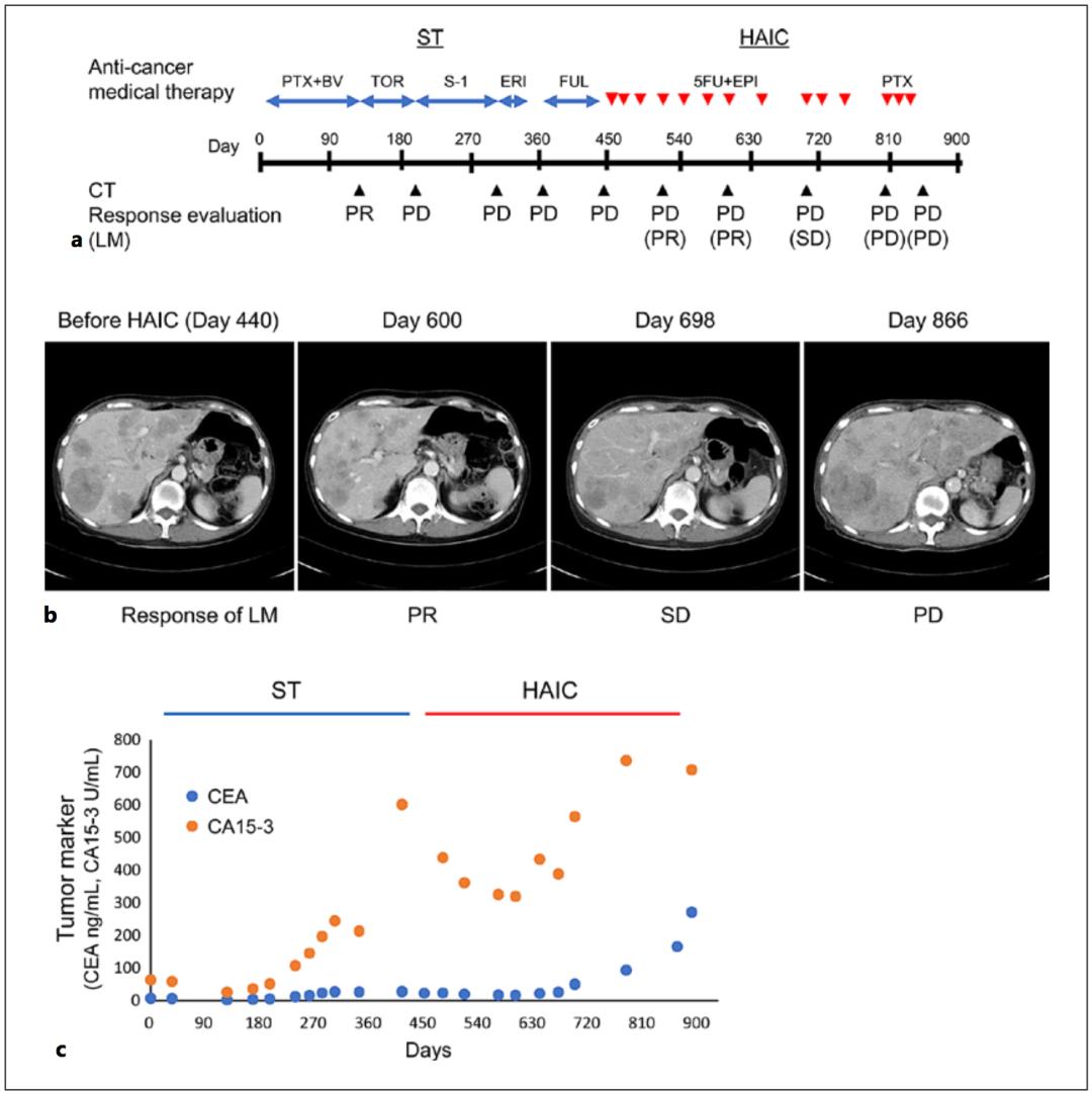 全身化疗能根治癌症吗,全身化疗的副作用有哪些
