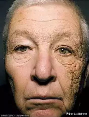 防晒霜最大内幕,夏日防晒霜致癌