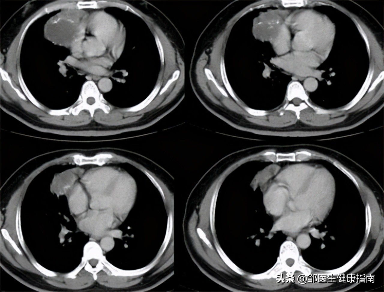 子宫内发现毛发是什么原因,女生检查子宫是为什么