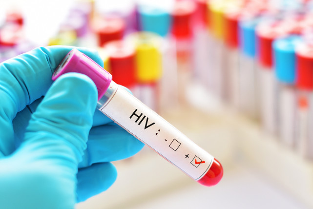 交往之前，如何知道对方有没有艾滋病？