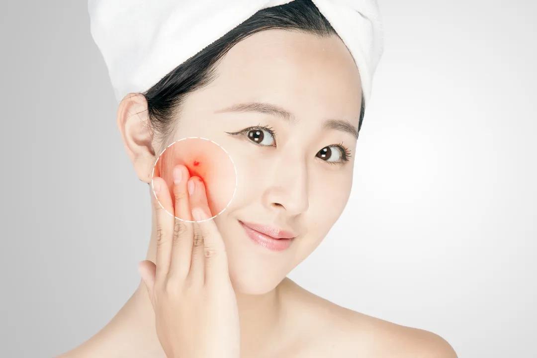 使用化妆品过敏应该怎么处理赔偿,新买的化妆品怎么测试过敏